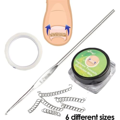 8pcs/set Ingrown Toe Nail Correction Wire Fixer Pedicure Recover Paronychia Acronyx Onyxis Bunion Corrector Foot Care Tool