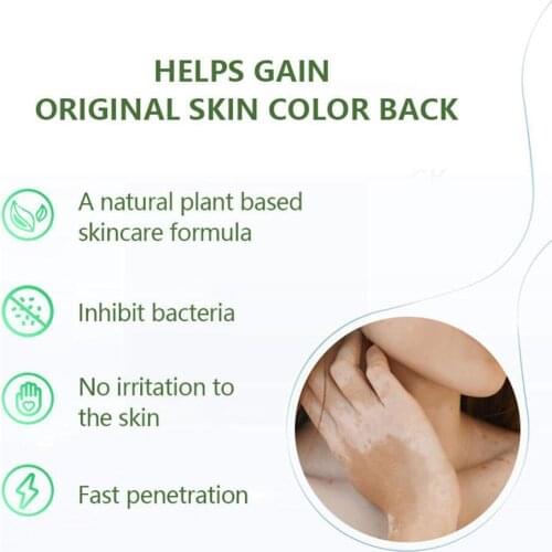 Skin Spot Care And Health Cream Psoriasis Cream Natural Vitiligo Cream Chinese Medicine External Skin Use P0B3