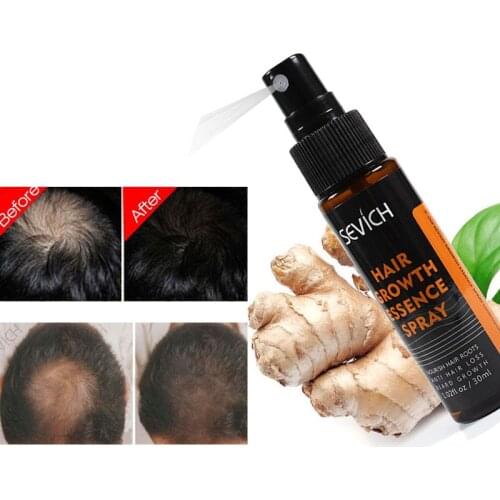 30ML Hair Regrowth Essences Spray Repair Scalp Hair Follicles Prevent Hair Loss Hair Growth Spray Fast Grow Hair Care Products