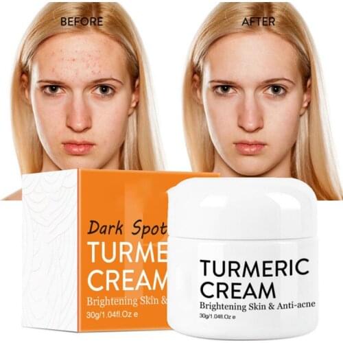 New Herbal Turmeric Cream Brighten skin tone repair acne nourish skin moisturize whiten and hydrate moisturizing cream 30ml