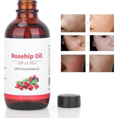 118ml Rosehip Oil Massage Essential Oil Moisturizing SPA Aromatherapy Body Massage Oil