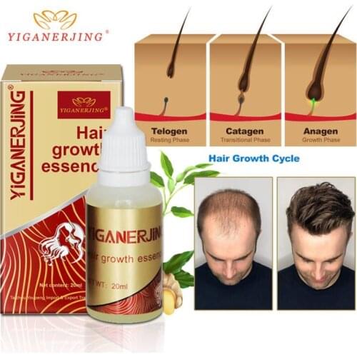Hair Growth Ginger Oil Natural Plant Essence Faster Grow Hair Tonic Toppies Shampoo No Hair Loss Hair Care Beauty Tools