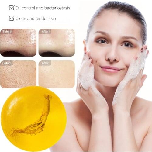 Ginseng Whitening-Soap Psoriasis Anti-Fungus Hydrating Hand-Made Eczema Deep-Cleaning Bath Moisturizing Soap Oil Control 100g