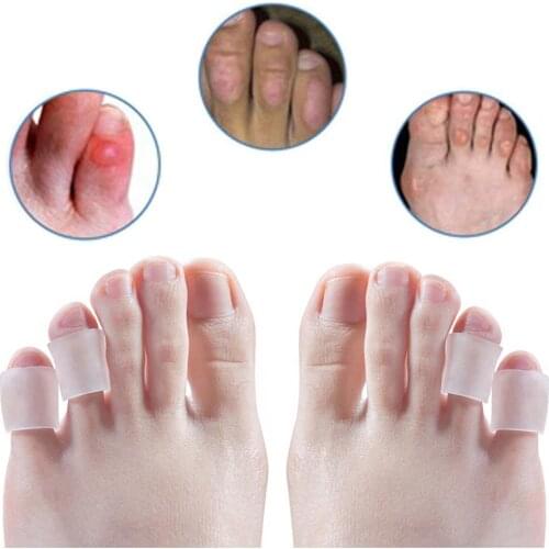 5pcs Silicone Toe Tube Separator For Corn Blister Rupture Pinky Protector Gel Hammer Toe Correction Pain Relief Foot Care Tool