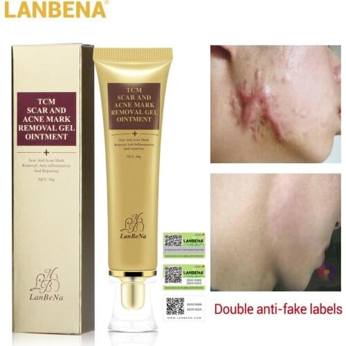 Acne Scar Removal Cream Stretch Marks Scar Treatment Gel Skin Repair Face Anti Acne Spots Skin Care Whitening Fade Pimples
