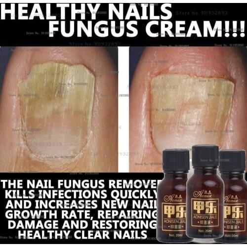 NAIL BRIGHT NAIL FUNGUS CREAM LOTION STOPS BRITTLE BROKEN NAILS ANTI FUNGAL