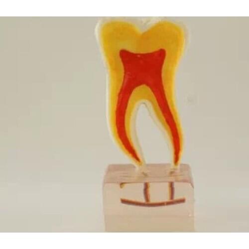 6 Times Anatomy Teeth Model Tooth Anatomy Model
