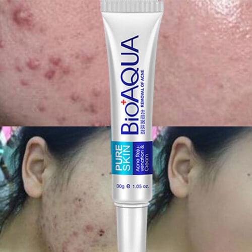 Effective Acne Removal Cream Acne Treatment Fade Acne Spots Oil Control Anti-Acne Shrink Pores Whiten Face Gel Skin Care BIOAQUA