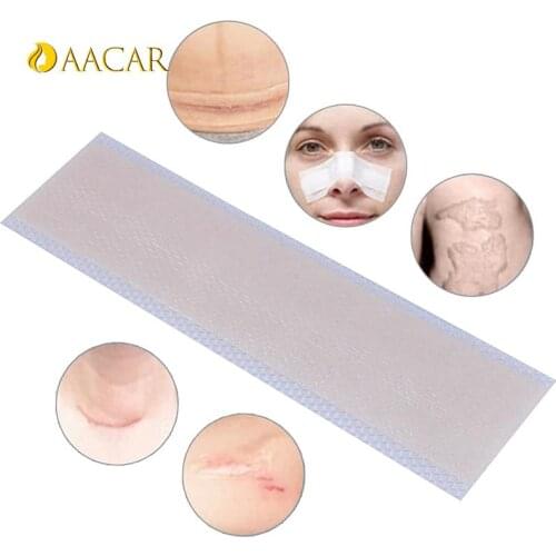 Trauma Sheet Skin Repair Scar Removal Patch For Acne Scar Treatment 1pc Silicone Scar Burn Scar Removal Therapy Patch Remove