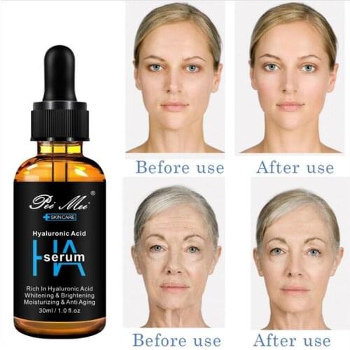 30ML Hyaluronic Acid Serum Moisturizing Face Essence Whitening Lifting Firming Anti Wrinkle Cream Acne Treatment Skin Care