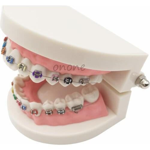 1pcs Orthodontics Model for Dentist Dental 1/2 Standard Dentition with Full Metal Brackets Teeth Model
