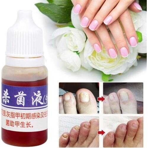 10ml Nail Fungus Disinfect Water Repair Treatment Disinfect Liquid Cleanser Onychomycosis Remover Serum Beauty Skin Care TSLM2