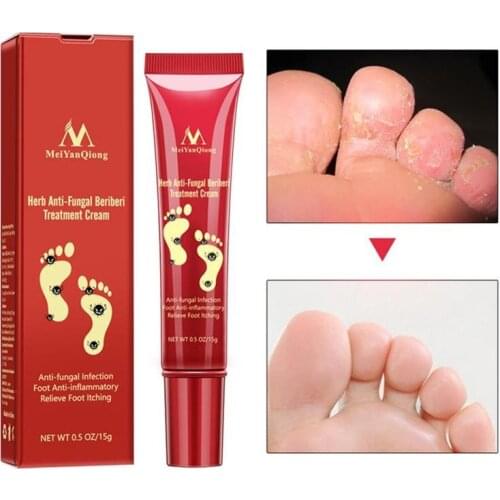 Foot Care Cream Anti-fungal Infection Foot Anti-inflammatory And Relieving Foot Itching Treatment Cream