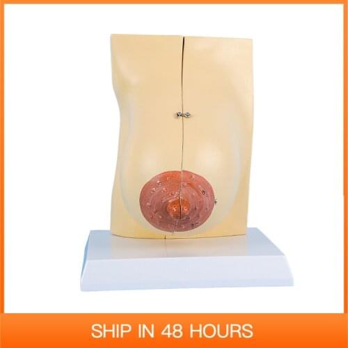Supply Breast Model During Lactation Medical Teaching Anatomical Human Female Chest Structure Supplies