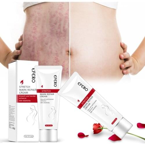 40g Remove Pregnancy Scars Skin Body Cream Postpartum Stretch Marks Repair Cream Anti-Aging Skin Winkles Firming Body CreamTSLM2