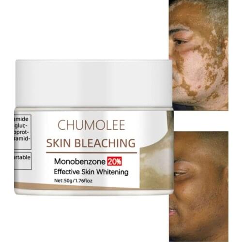 Chumolee Monobenzone Face Whitening Cream Skin Bleaching Vitiligo Treament Fade Dark Spots Age Spot Melanin Brighten Face Care