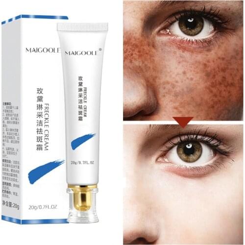 Powerful Whitening Freckle Cream Remove Melasma Acne Spot Pigment Melanin Dark Spots Pigmentation Moisturizing Gel Skin Care