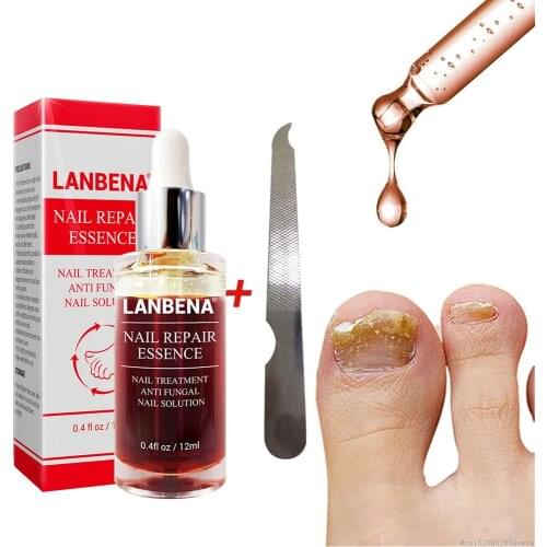Cream from Nail Fungus Labena Toenail Repair for Fungi Lanbena Against Onychomycosis Leg Remedy Lambena Antifungal Foot Mushroom