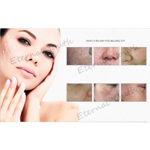 Chinese Medicine Skin Care Products Pearl Cream Whitening Face Acne Speckle Freckle Moisturizing Acne Treatment 25g