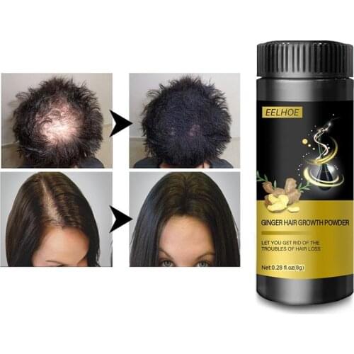 Ginger Hair Growth Powder Essence Hair Loss Health Treatment Hair Loss Beauty Dense Hair Growth Serum Hair Care Products Series