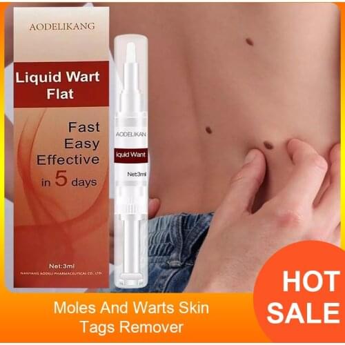 3ml Liquid Genital Wart Treatment Papillomas Removal Of Warts Skin Tags Removing Against Moles Remover Anti Verruca Remedy