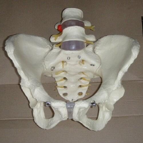 1: 1 Teaching medical teaching aids of human pelvis model (pathological changes 2 lumbar vertebrae)