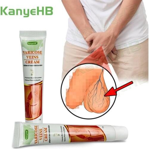 2pcs Genital Varicocele Remover Treatment For Varicose Veins Cream Varicosity Angiitis Removal Phlebitis Leg Veins Pain Ointment
