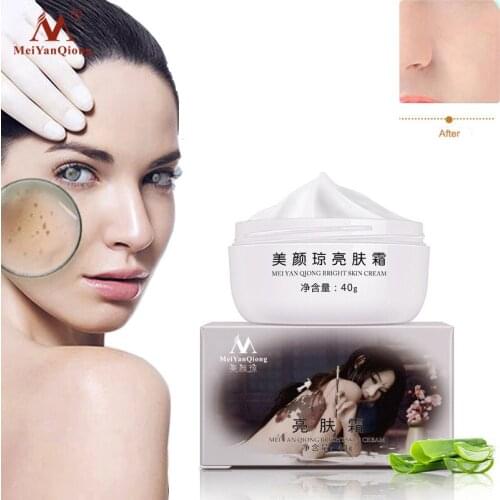 Strong Effects Powerful Whitening Freckle Cream Remove Melasma Acne Spots Pigment Melanin Moisturizing Face Skin Care 40g
