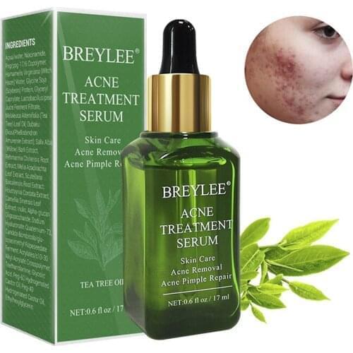 17ml Acne Treatment Serum Face Facial Anti Acne Scar Removal Cream Skin Care Whitening Repair Pimple Remover Face Serum