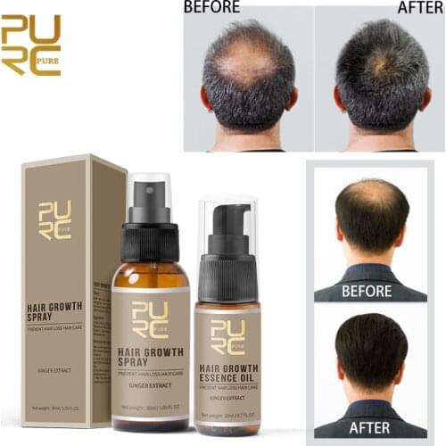 PURC Fast Growth Hair Essence Essential Oil Liquid Treatment Preventing Hair Loss and Hair Grwoth Spray Hair Care