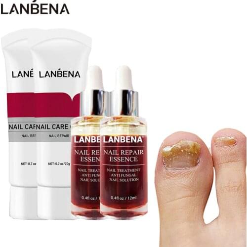4pcs LANBENA Fungal Nail Treatment Essence Anti Infection Nail Fungus Removal Cream Set Paronychia Onychomycosis Nail Care
