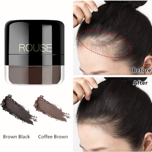 Ilisya Hair Loss Remedies