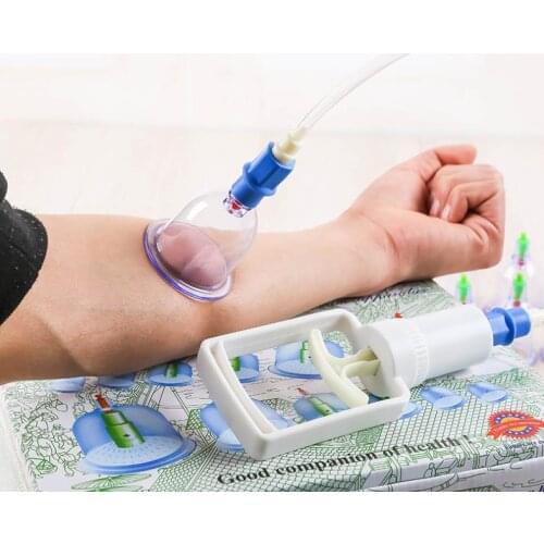 Vacuum cupping device suction cupping foam filling health clearing damp god
