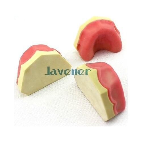 Dental Tooth Implant Practice Model Mandible Gingiva Model Teaching Model
