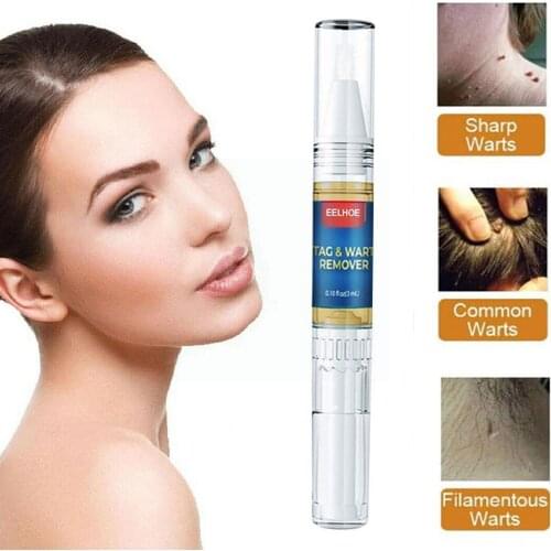 Skin beauty mole removal pen Repair No Trace Beauty Of Skin Pen Warts Papilloma Liquid Removal Treatment Mole N0Y5