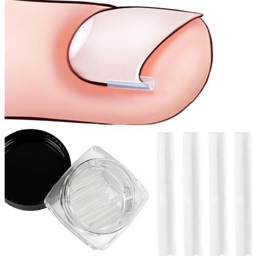 10Pcs Ingrown Nail Filler Nail Pad Nail Groove Toenails Corrector Pedicure Tool Paronychia Treatment Bunion Correction Pads Wire