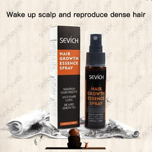 30ml Fast Hair Growth Spray Hair Loss Treatment Help For Hair Growth Hair Care Hair Growth Products Hair Loss Products