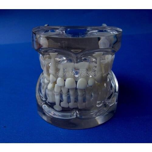 5 to 9 Years Old Tooth Development Model,Baby Teeth Model,Permanent Teeth Model