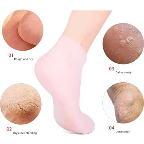 1 Pair Silicone Moisturizing Spa Gel Heel Socks Exfoliating Preventing Dryness Foot Skin Rejuvenation Foot Care Elastic Sock