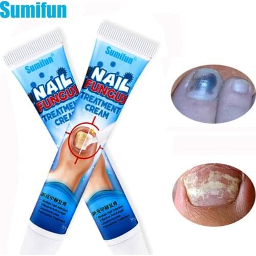 1pcs Nail Repair Cream Antibacterial Repair Ointment Whitening Toe Care Treatment Foot Nail Fungus Removal Medical Plaster