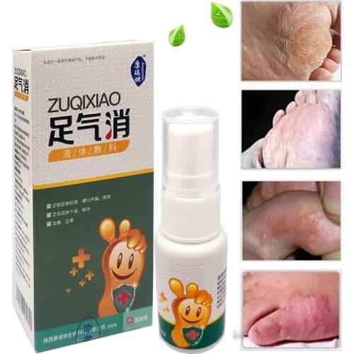 20ml Natural Herbal Foot Spray To Remove Rough Cracked Peeling Moss And Itchy Feet Which Effectively Clean And Inhibits Bacteria