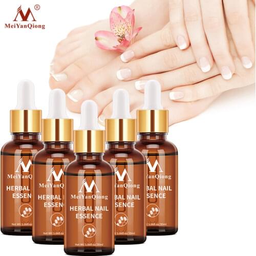 5PCS Fungal Nail Treatment Feet Care Essence Nail Foot Whitening Toe Nail Fungus Anti Fungal Nail Infection Good Toenail 30ml