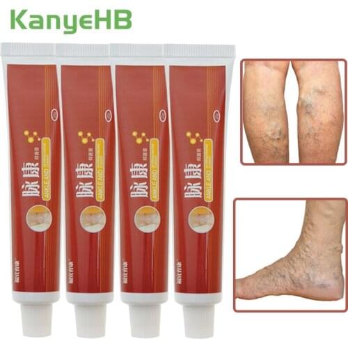 4pcs Treatment For Varicose Veins Chinese Herbal Medicine For Varicosity Angiitis Removal Phlebitis Leg Veins Pain Ointment A430