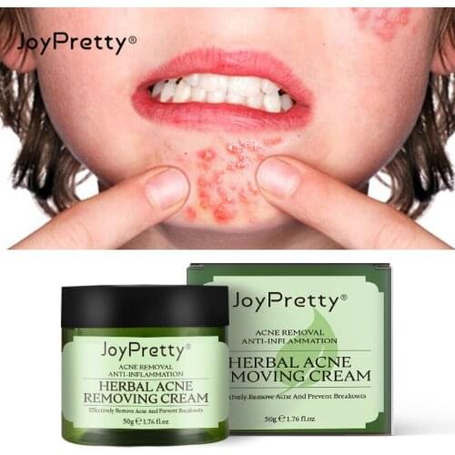 Herbal Acne Treatment Cream Effective Fade Acne Scar Removal Spots Oil Control Shrink Pores Moisturizing Anti-Acne Face Gel Care