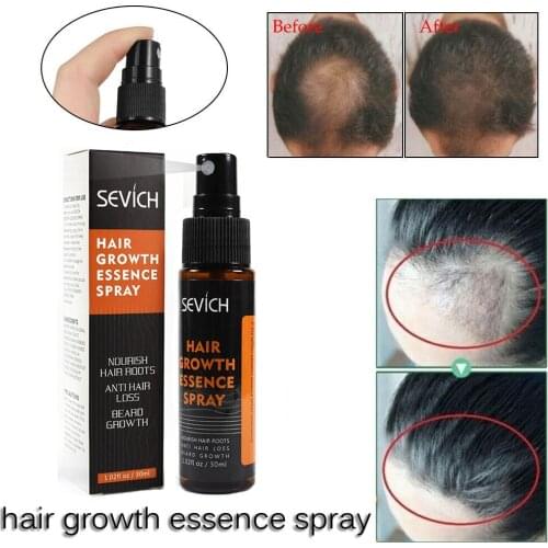 Hair Growth Essence Spray 20ml Hair Grows Restoration Prevent Baldness Dropshipping Discounted Price Hair Growth Care Products