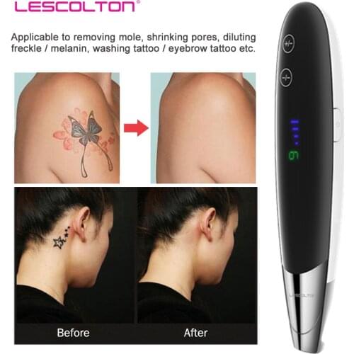 Tattoo removal machine laser picosecond pen remover Rattoo Mole Freckle Dark Spot Eyebrow Pigment Laser Beauty Care Machine