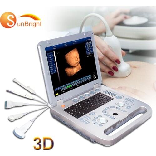 Hot Sale And Best Seller 3D 4D Portable Ultrasound Machine economic/ecografo ultrasonido portatil en 3d 4d