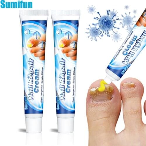 2pcs New Nail Treatment Essential Ointment Remove Onychomycosis Fungus Paronychia Promote Nail Growth Anti Infection Nail Care