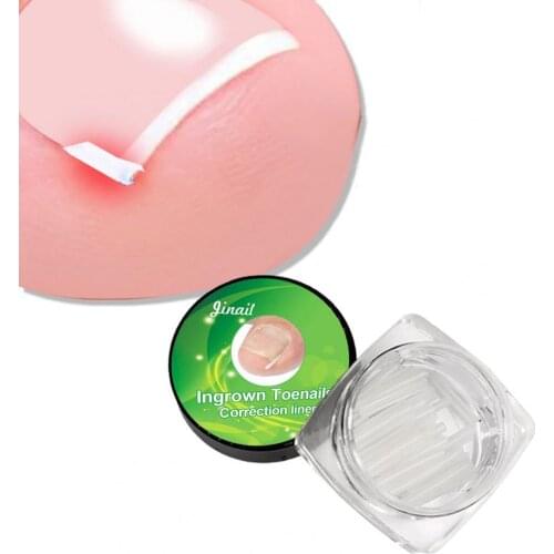 80% Hot Sale 10Pcs/Box Nail Groove Pad C-Shaped Slot Isolate Toenails Soft Ultra Thin Plastic Toenail Filling Patch for Unisex