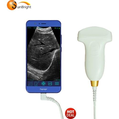 USB Probe Ultrasound Scanner Type-C Ultrasound Convex Transducer For PC/Laptop